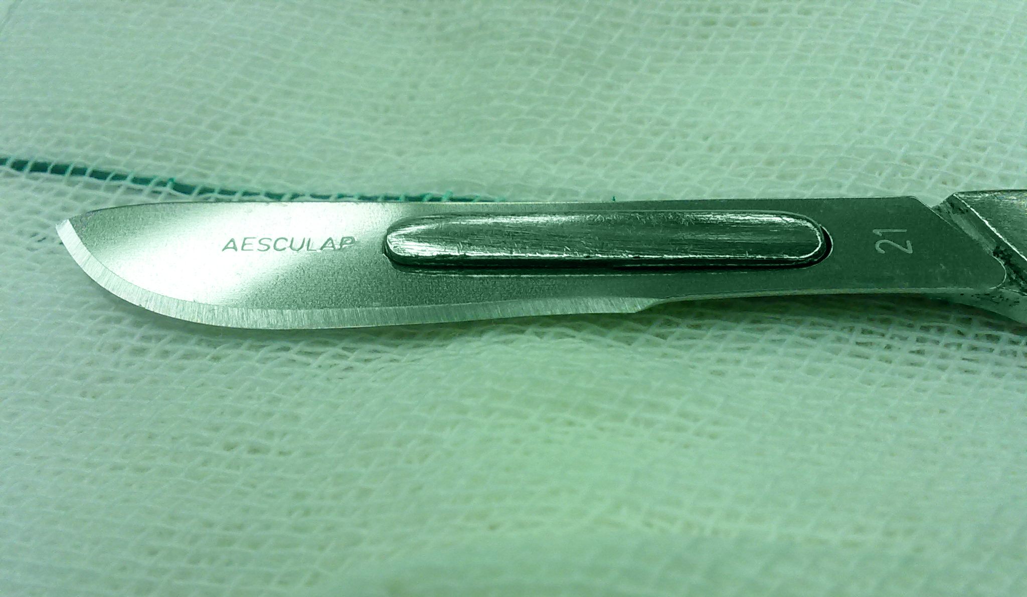 Your Body Your Choice: The Silent Scalpel of Intersex Surgeries